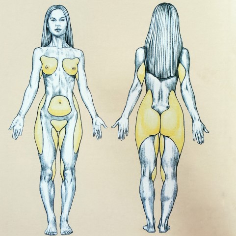 fat distribution women sketch (Small)